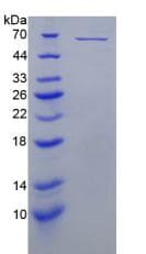 Mouse PRF1 / Perforin Protein (Recombinant His-GST, N-terminus)