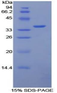 Rabbit F3 / CD142 / Tissue factor Protein (Recombinant His-S)