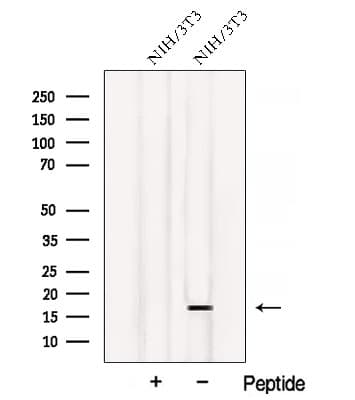 ATP5D Antibody