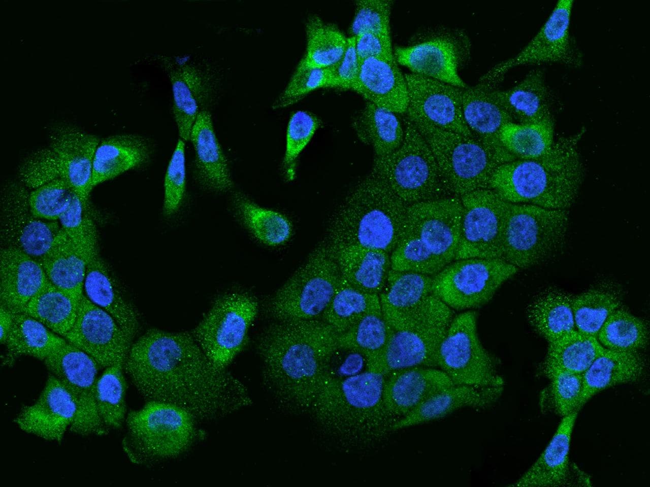 DENN / MADD Antibody