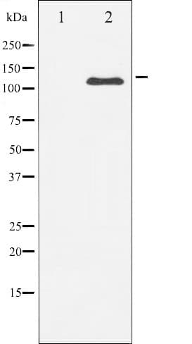 Polyclonal Rabbit anti-Human PDGFRB / PDGFR Beta Antibody (WB)