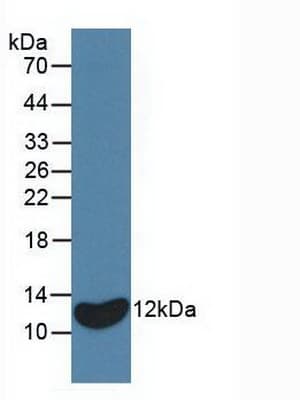 IL8 / Interleukin 8 Antibody (FITC)