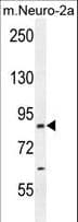 CEP89 Antibody (aa658-687)