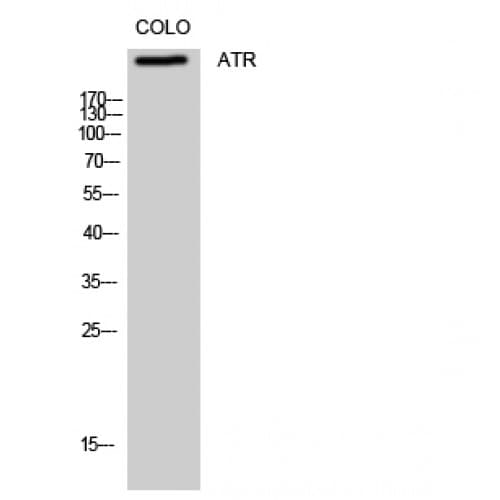 Polyclonal Rabbit anti-Human ATR Antibody (370-450 aa, IHC, WB)