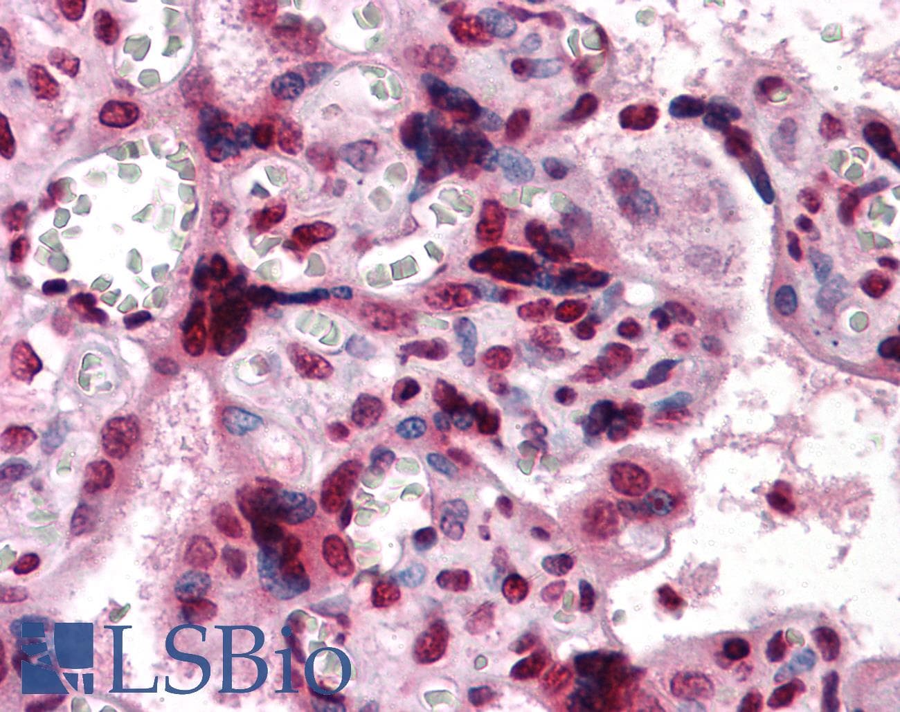 IHC-plus™ CSF1 / MCSF Antibody (clone 2D10)