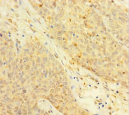 Polyclonal Rabbit anti-Human TP / Thymidine Phosphorylase Antibody