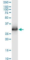 CELA3A / ELA3 Antibody (clone 3G4)