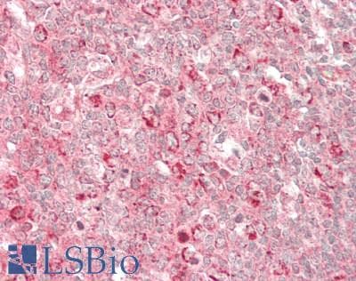IHC-plus™ Polyclonal Rabbit anti-Human CNR1 / CB1 Antibody (IHC, WB)