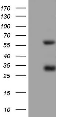 Monoclonal Mouse anti-Human MSLN / Mesothelin Antibody (clone OTI5B12, aa270-493, WB)