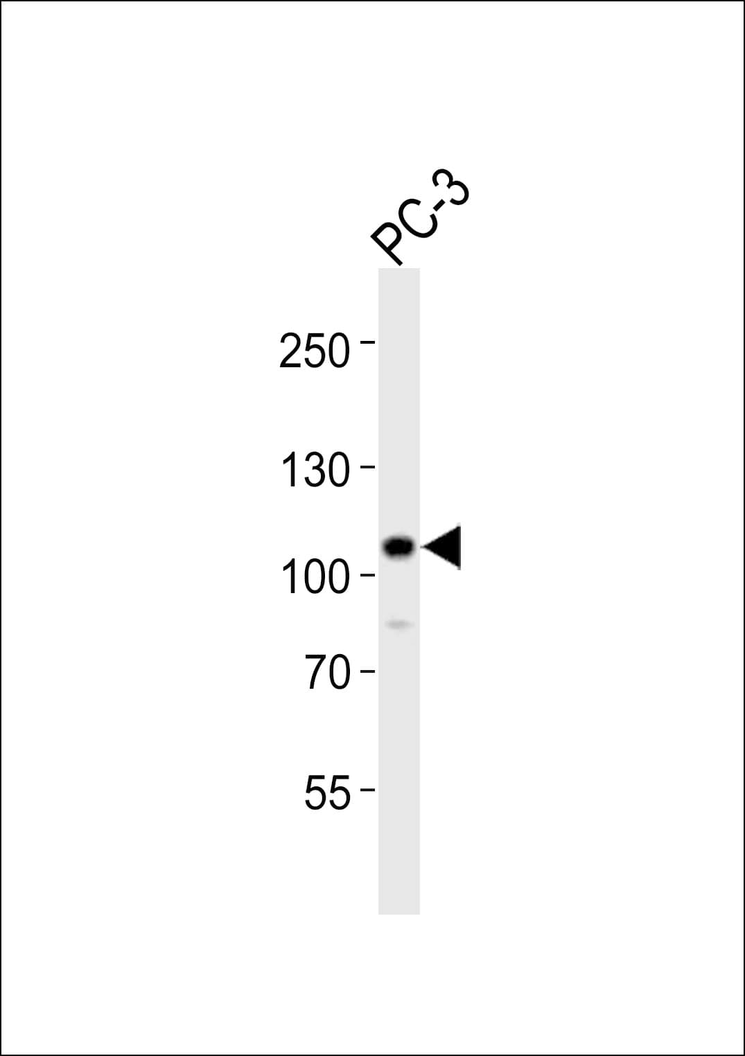 EPHB4 / EPH Receptor B4 Antibody (aa967-1000)