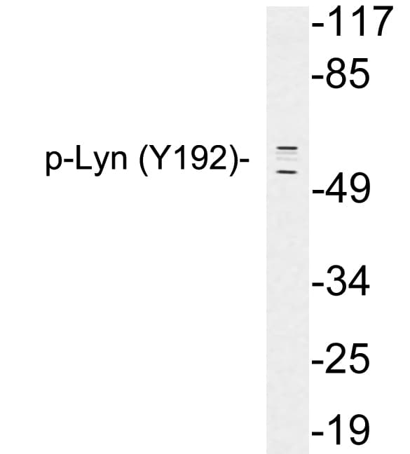 LYN Antibody (phospho-Tyr192)