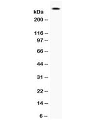 Polyclonal Rabbit anti-Human FLG / Filaggrin Antibody (IHC, WB)