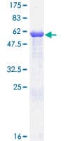 Human LDHB / Lactate Dehydrogenase B Protein (Recombinant GST)