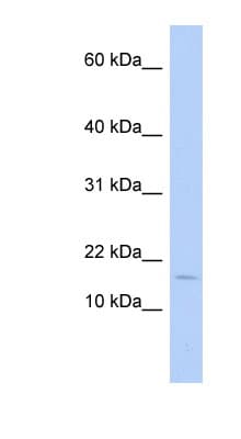 Polyclonal Rabbit anti-Human ISA2 / ISCA2 Antibody (aa35-84, WB)