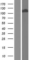 Human TDRD5 Protein (Over-Expression Lysate Myc-DDK (Flag))