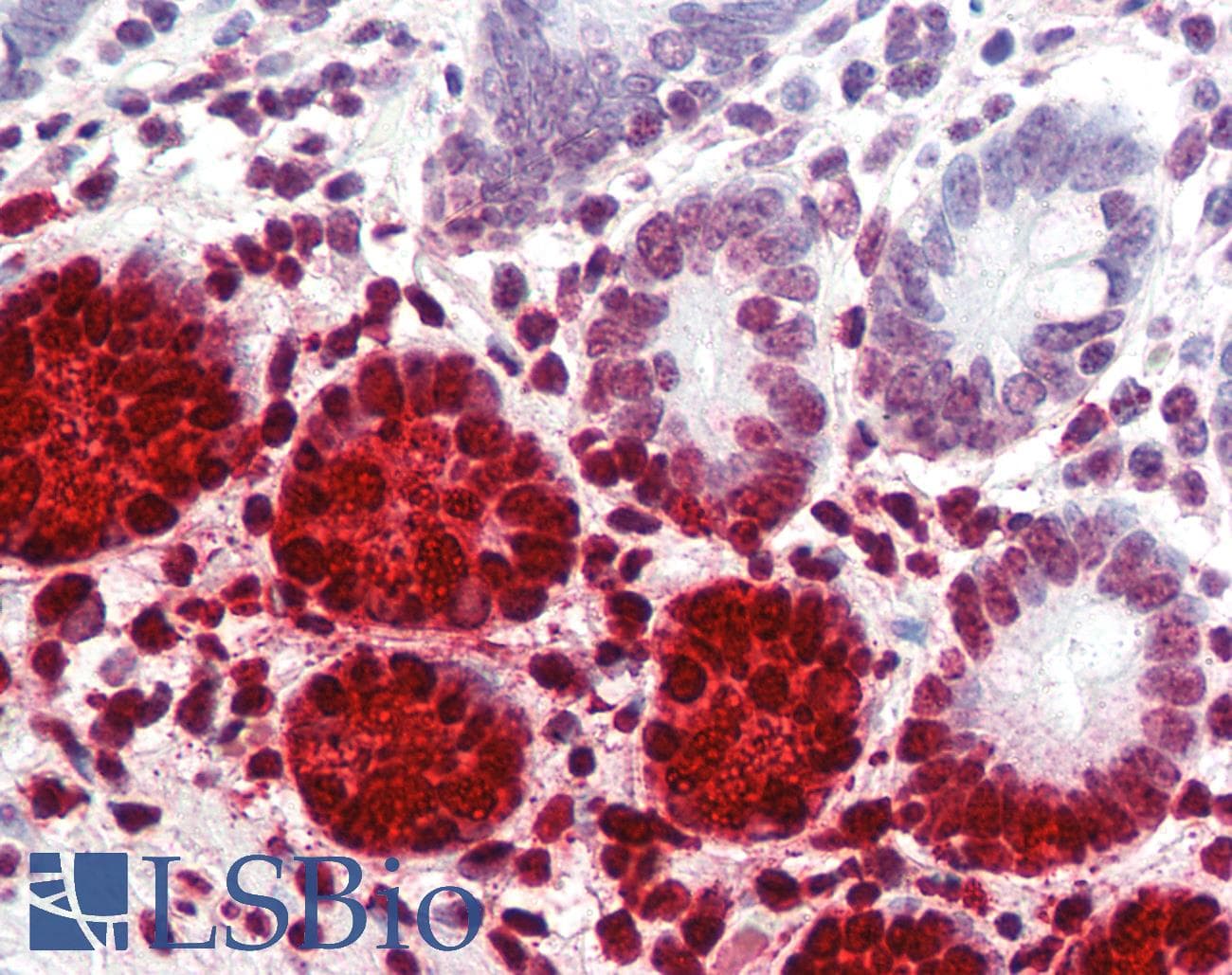 IHC-plus™ DEFA5 / Defensin 5 Antibody (clone 8C8)