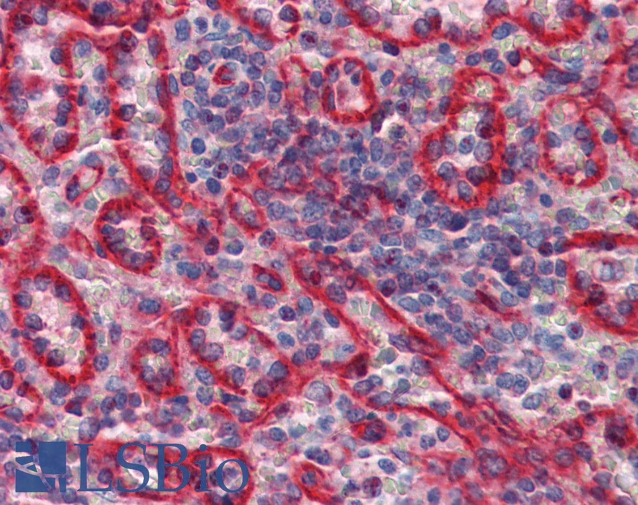 IHC-plus™ Monoclonal Mouse anti-Human HLA-E Antibody (clone MEM-E/07, IHC)
