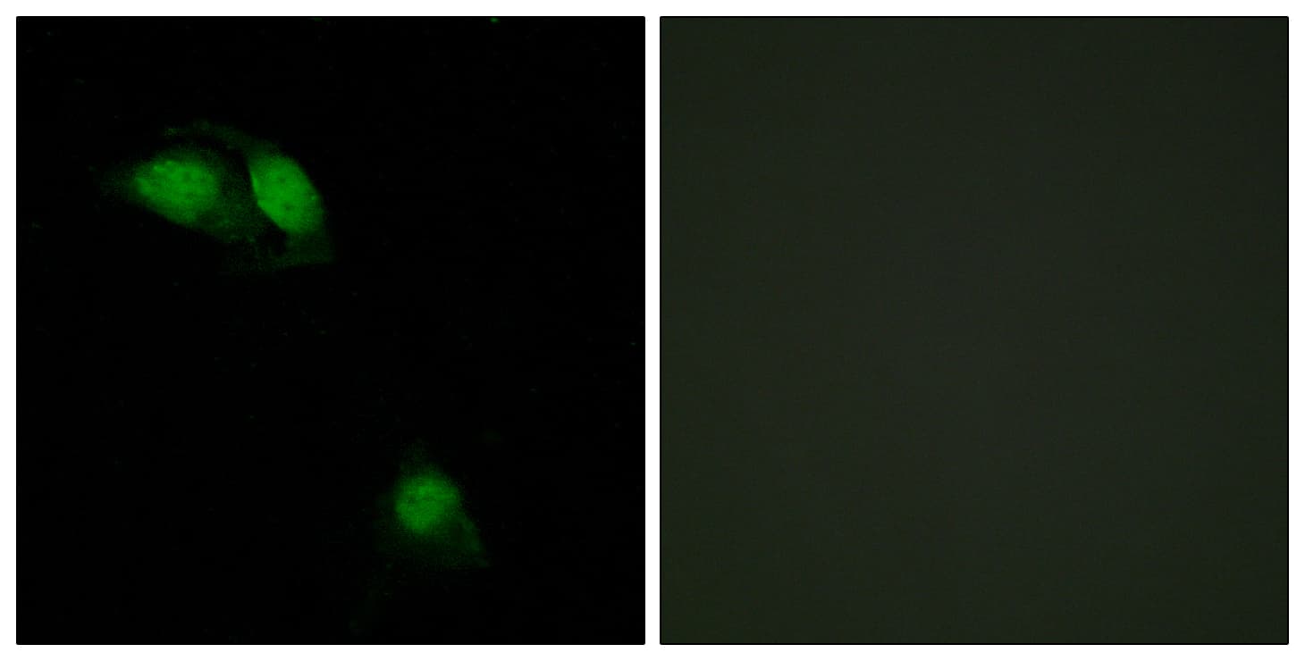 IRS1 Antibody (phospho-Ser312)