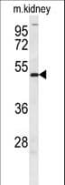 DMRTA3 / DMRT3 Antibody (aa431-459)