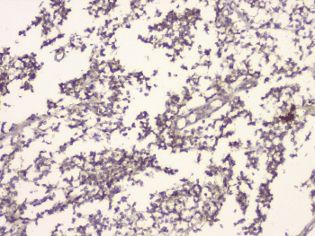 APP / Beta Amyloid Precursor Antibody