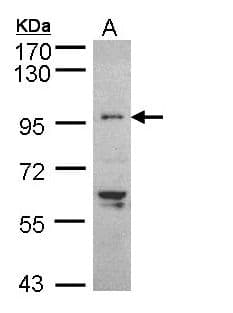 TNNI3K / CARK Antibody (aa187-403)