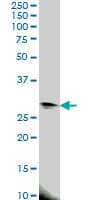 EIF4E2 / IF4e Antibody (clone 4G10)