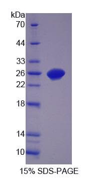 Pig CNTF Protein (Recombinant His-S)