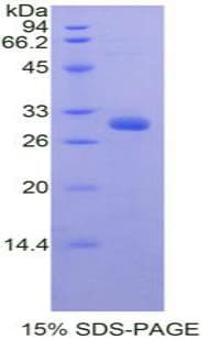 Mouse BLIMP1 / PRDM1 Protein (Recombinant His-T7)