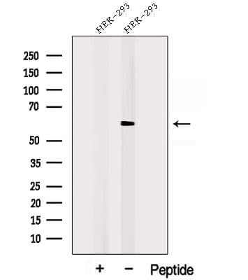 Polyclonal Rabbit anti-Human POPDC3 Antibody (WB)