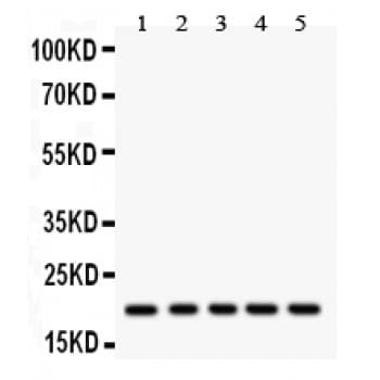 RAC1 Antibody (aa169-189)