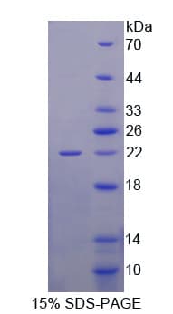 Human GAD65 Protein (Recombinant His, N-Terminal)