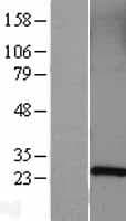 Human RAB5A / RAB5 Protein (Over-Expression Lysate Myc-DDK (Flag))