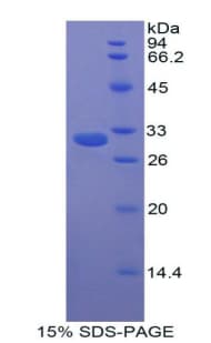 Rat CPB2 / TAFI Protein (Recombinant His)