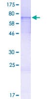 Human TXNIP Protein (Recombinant GST, N-terminus)