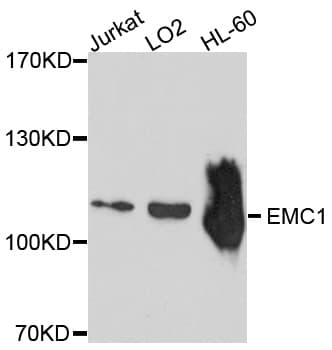 Polyclonal Rabbit anti-Human EMC1 Antibody (WB)