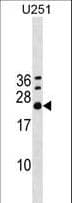 EXOSC4 / RRP41 Antibody (aa69-96)