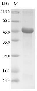 Rat TPSAB1 / Mast Cell Tryptase Protein (Recombinant 10His-SUMO, N-terminus + Myc, C-terminus)