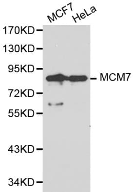 Polyclonal Rabbit anti-Human MCM7 Antibody (IHC, WB)