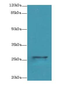 TMEM217 Antibody