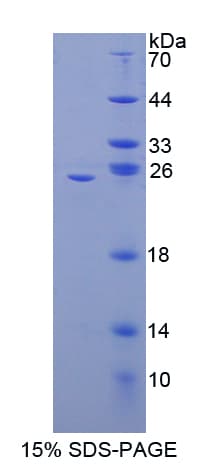 Mouse NFKB2 Protein (Recombinant His-T7)