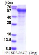 Human PCID2 Protein (Recombinant His)