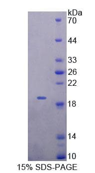 Mouse MTX1 / Metaxin 1 Protein (Recombinant His-T7)