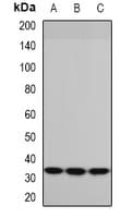 Polyclonal Rabbit anti-Human PYCR1 Antibody (IHC, WB)