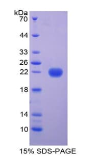 Bovine FTL / Ferritin Light Chain Protein (Recombinant His)