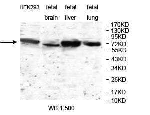 JAKMIP1 Antibody (aa282-436)