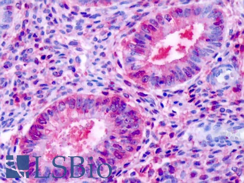 IHC-plus™ ESRRB / ERR Beta Antibody (N-Terminus)