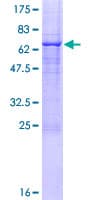 Human TLL1 Protein (Recombinant GST)