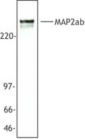 Monoclonal Mouse anti-Human MAP2 Antibody (clone MT-08, IHC, WB)