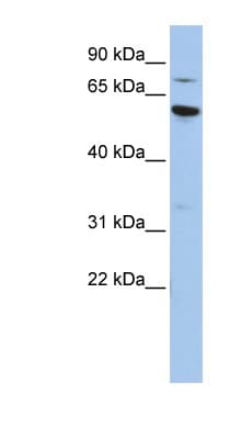 Polyclonal Rabbit anti-Human ME1 / Malate Dehydrogenase Antibody (aa36-85, WB)