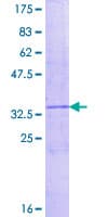 Human CXCL1 / GRO Alpha Protein (Recombinant GST)